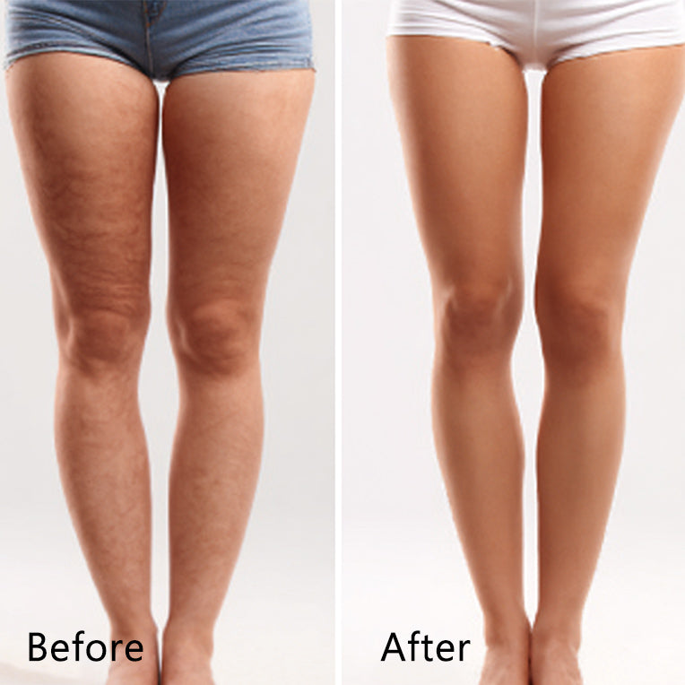 Gua Sha before and after for legs